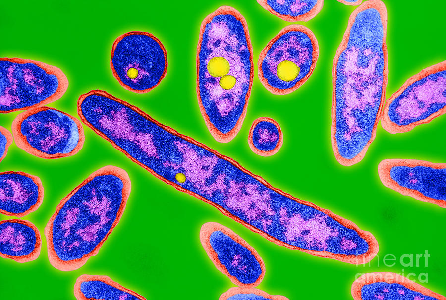 Bacteria Photograph - Legionnaires Disease Bacteria by Science Source