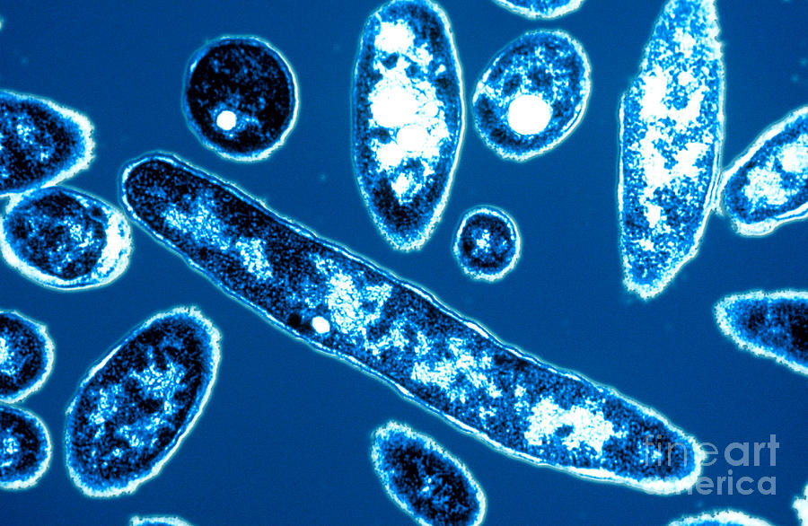 Legionnaires Disease Photograph by Science Source