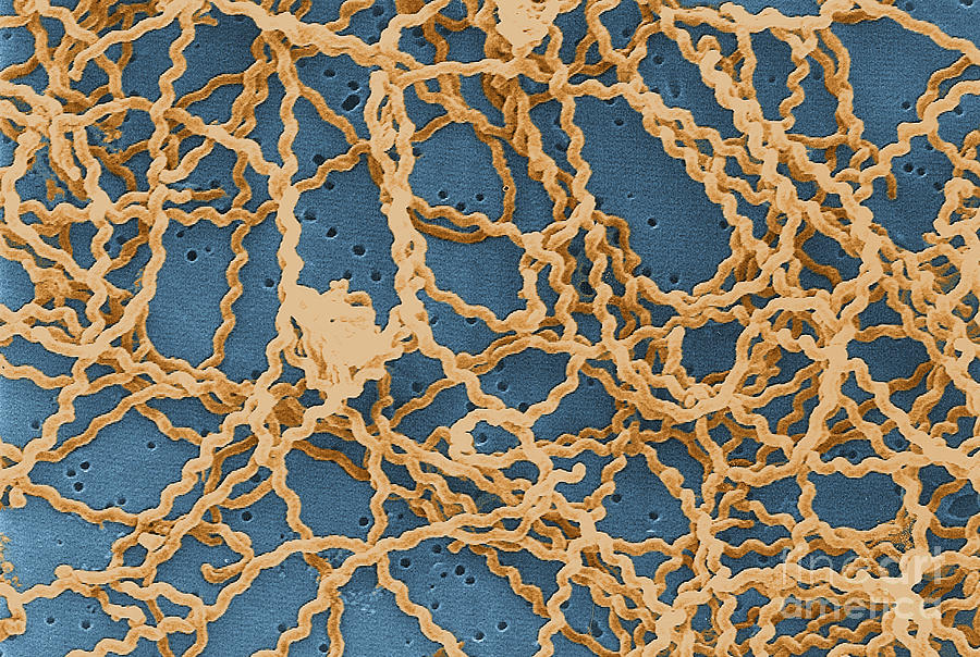 Leptospira Photograph by Science Source