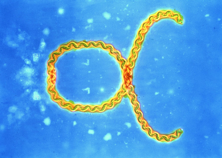 Leptospira Sp. Bacterium Photograph by Cnri - Pixels