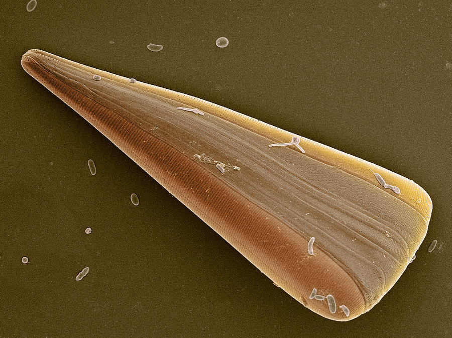 Nature Photograph - Licmophora Diatom Alga, Sem by Steve Gschmeissner