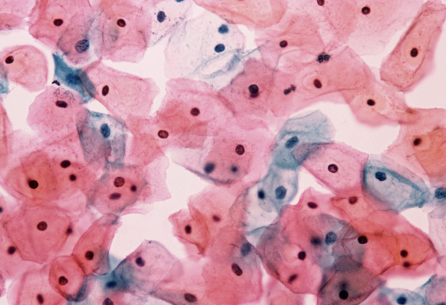Endocervical Cells Photograph - Light Micrograph Of Normal Cells In Cervical Smear by Dr. E. Walker