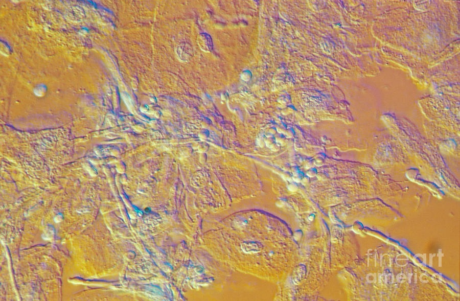 Nomarski Microscopy Photograph - Living Candida Albicans by M. I. Walker