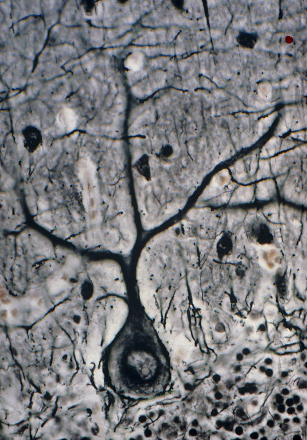 Lm Of A Purkinje Cell In The Cerebellum Photograph by Volker Steger