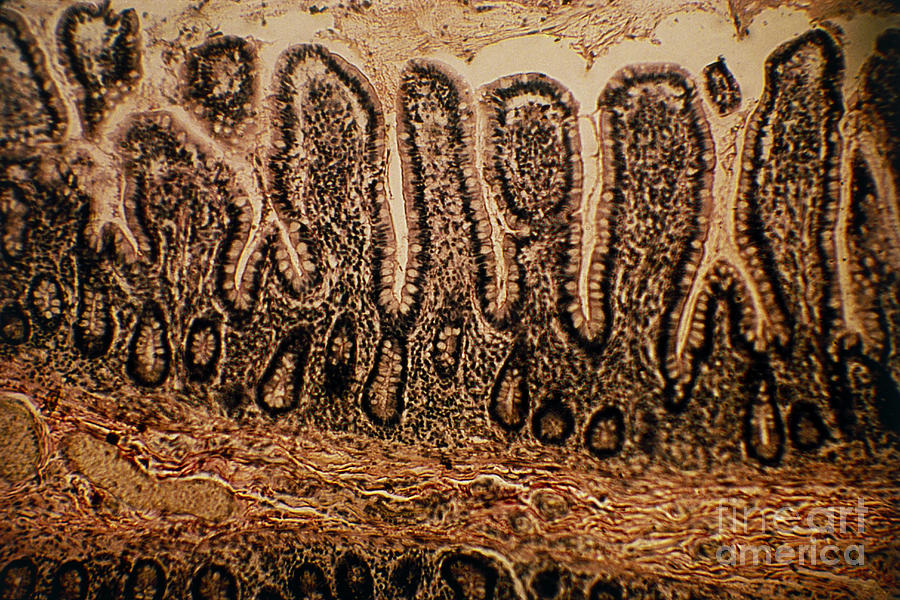 Lm Of A Section Through The Human Photograph by Eric Grave
