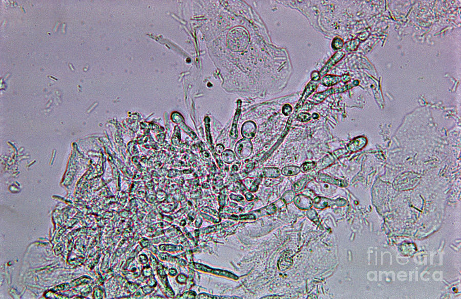 Lm Of Candida Albicans Photograph by M. I. Walker