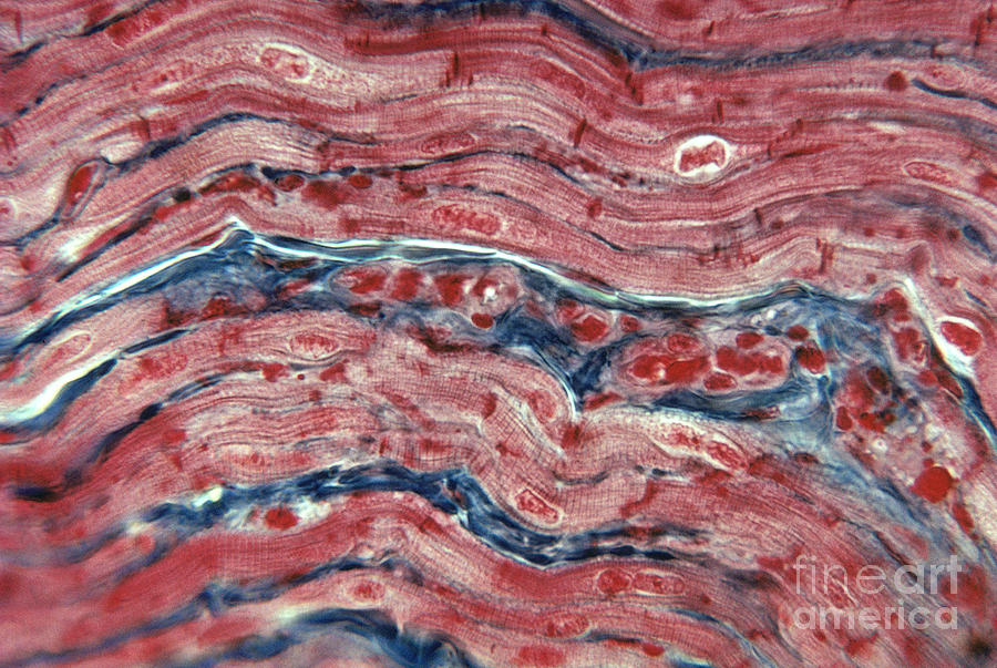 Cell Photograph - Lm Of Cardiac Muscle by Eric V. Grave