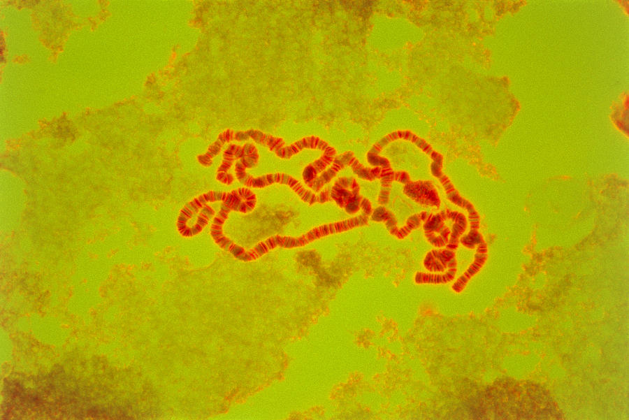 Lm Of Chromosome From Calliphora Salivary Gland Photograph by Power And ...