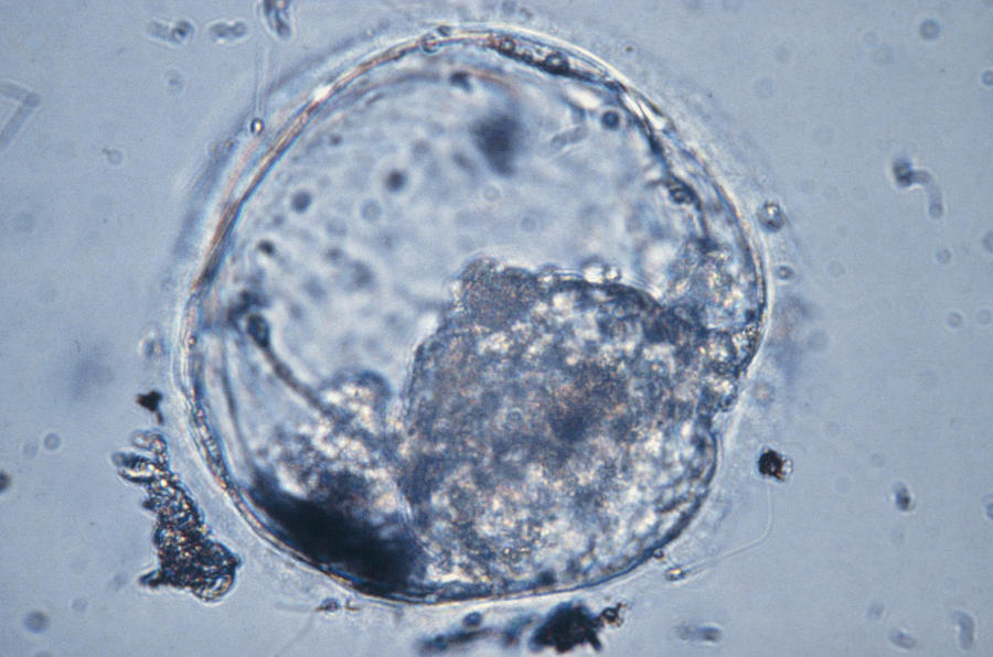 Lm Of Human Blastocyst, 4-5 Days Post-fertilisatn Photograph by Andy ...