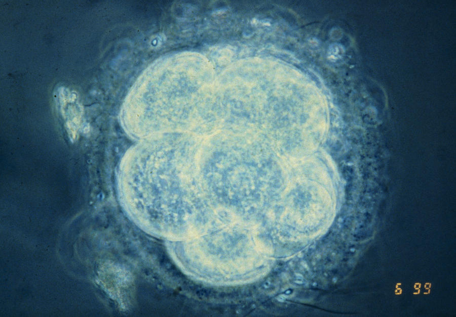 Lm Of Human Embryo At Eight Cell Stage Photograph by Andy Walker ...