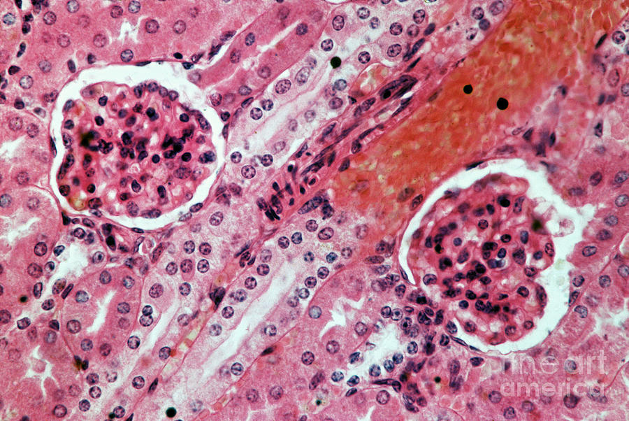 Lm Of Kidney Glomeruli Photograph by M. I. Walker