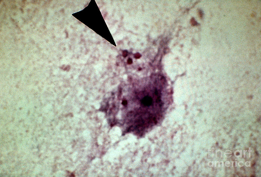 Lm Of Negri Bodies Photograph by ASM/Science Source