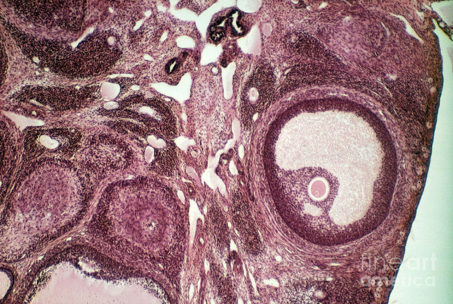Lm Of Ovarian Follicle Photograph by M. I. Walker
