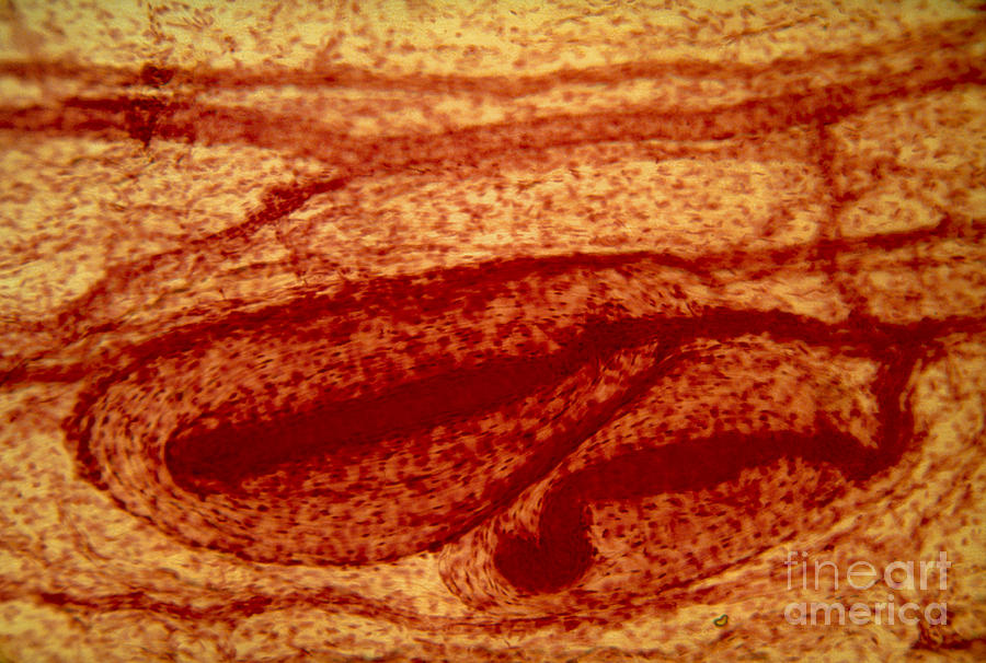 Lm Of Pacinian Corpuscles In Human Skin Photograph by Eric Grave