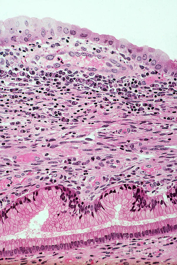 Histology Photograph - Lm Of Uterus by M. I. Walker