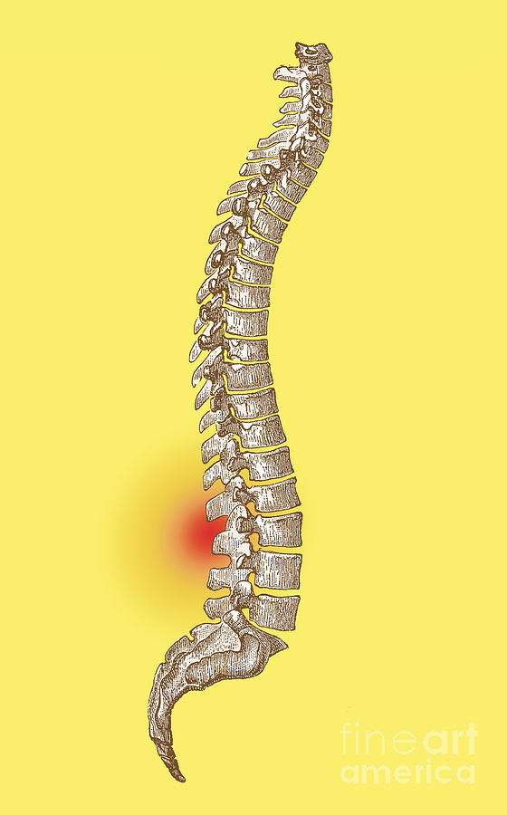 Lower Back Pain Photograph by Science Source