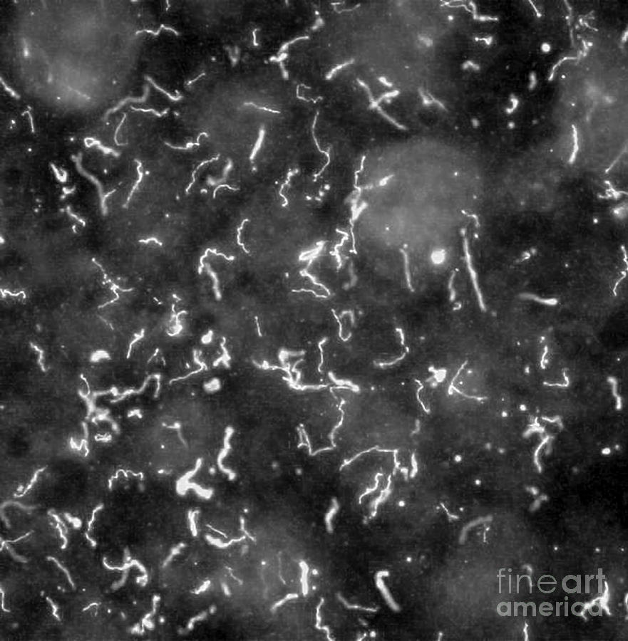 Microbiology Photograph - Lyme Disease, Borrelia Burgdorferi by Science Source