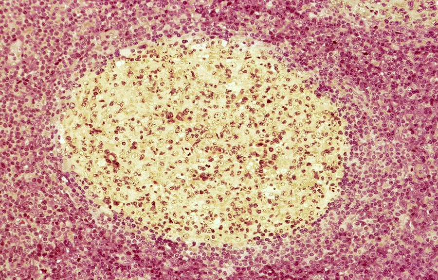 Lymph Node, Light Micrograph by Science Photo Library