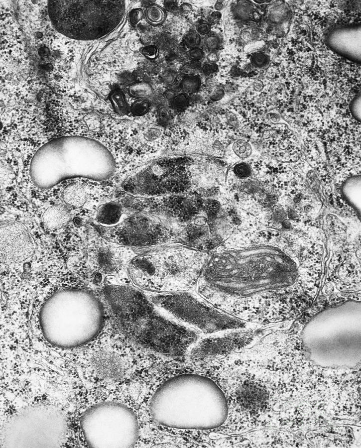 Lysosomes, Tem Photograph by Science Source