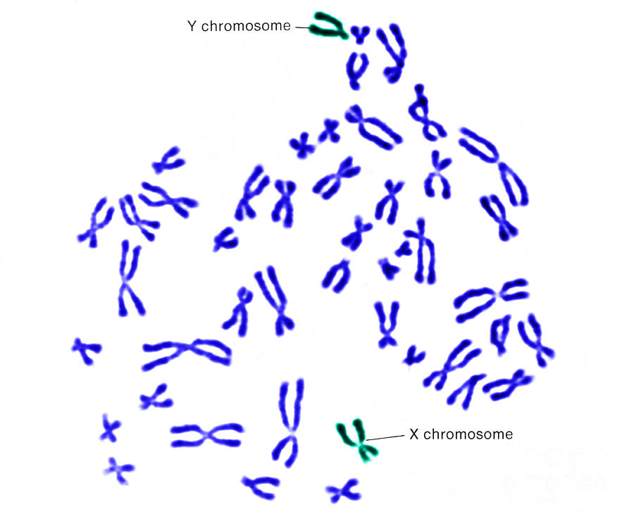 Male Karyotype Photograph by Science Source