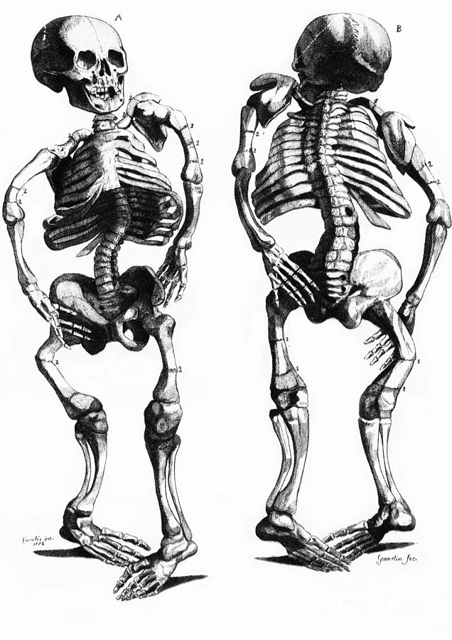 Malformed Skeletons Photograph by Science Source