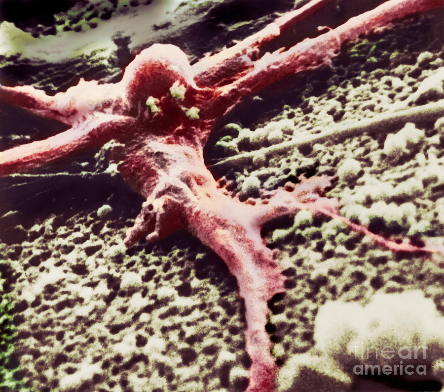 Malignant Cancer Cell Photograph by Omikron