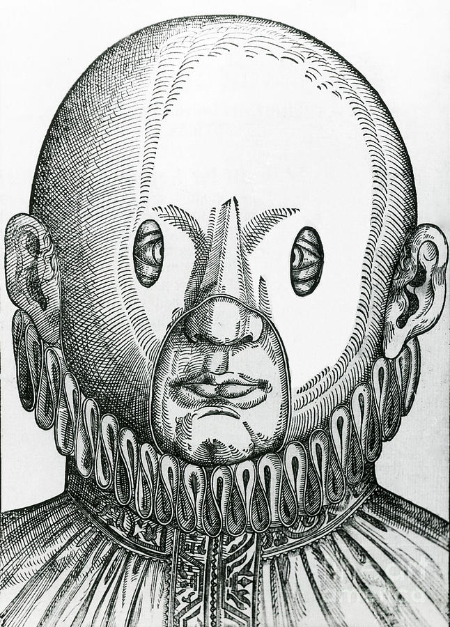 Mask For Correcting Crossed Eyes 1583 Photograph by Science Source