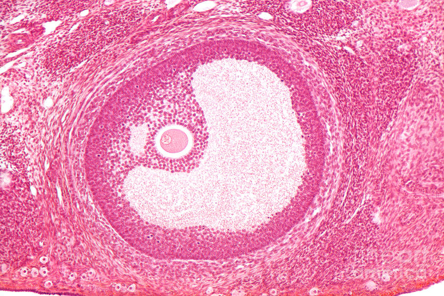 graafian follicle ultrasound