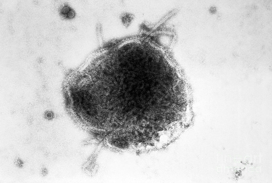 Measles And Simian Virus, Em Photograph by Science Source