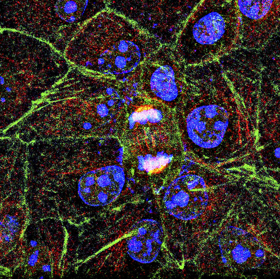 Mitosis, Fluorescence Micrograph Photograph by Biology Diagrams