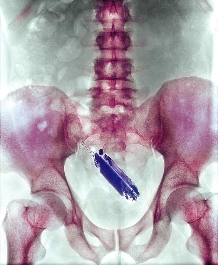 X Ray Pussy