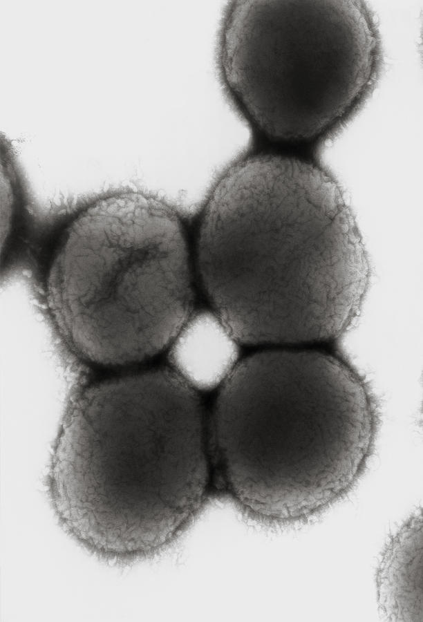 Moraxella Catarrhalis Bacteria Photograph By Dr Kari Lounatmaa