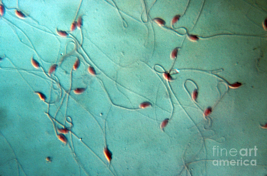 Mouse Spermatozoa Photograph by Eric V. Grave