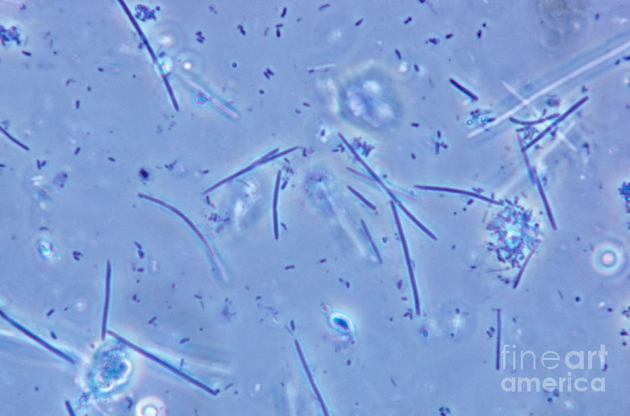 Бактерии в слюне. Микроорганизмы ротовой полости. Микроорганизмы ротовой полости под микроскопом. Микробы полости рта под микроскопом.