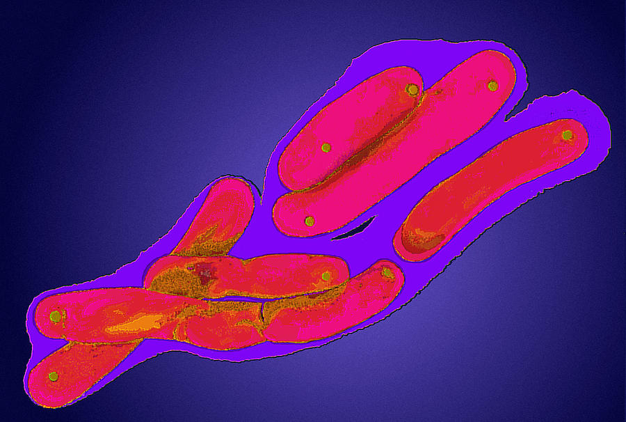 Туберкулез бактерия. Микобактериум туберкулезис. Микобактерия палочки Коха. Туберкулезная палочка палочка Коха. Микобактерия туберкулеза палочка Коха.