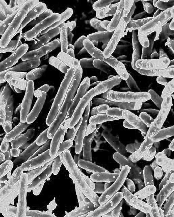 Microbiology Photograph - Mycobacterium Tuberculosis Bacteria, Sem by Science Source