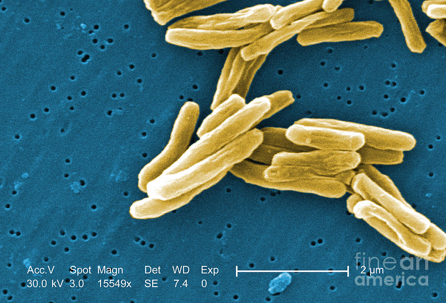 Mycobacterium Tuberculosis, Sem Photograph by Science Source