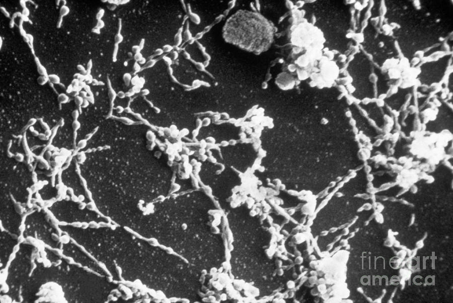 Mycoplasma Pneumoniae Sem Photograph by ASM/Science Source