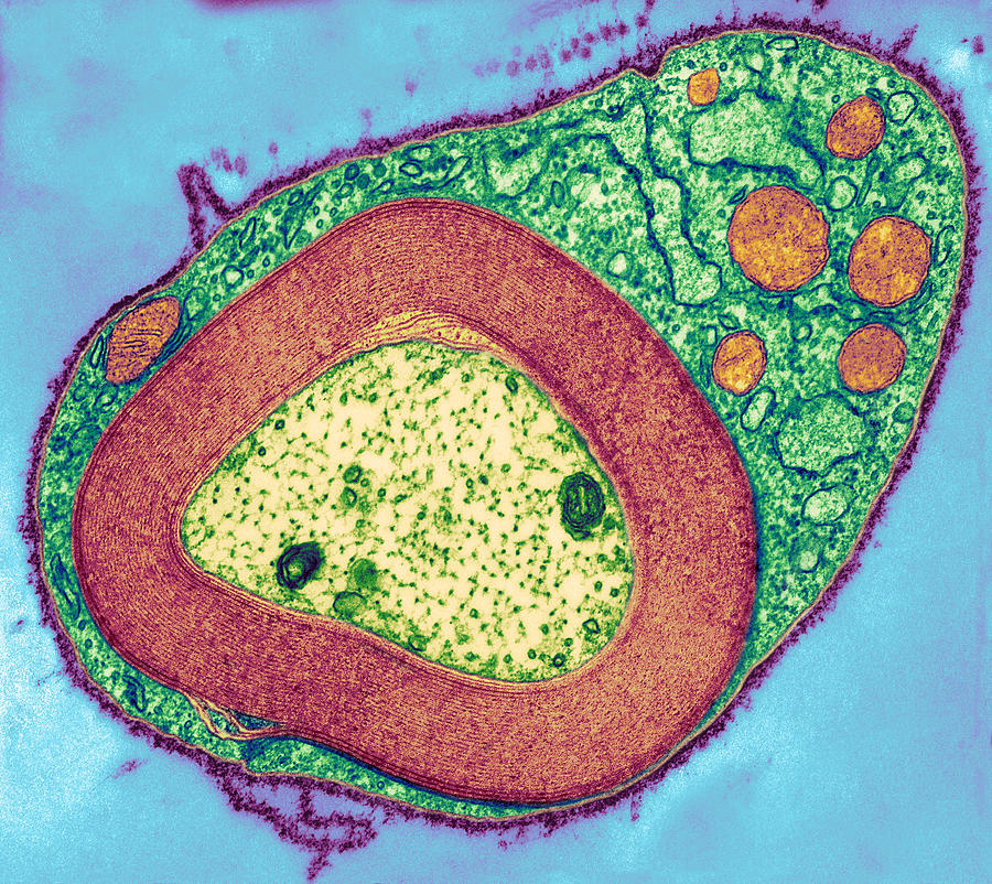 Myelinated Nerve, Tem Photograph by Thomas Deerinck, Ncmir - Fine Art ...