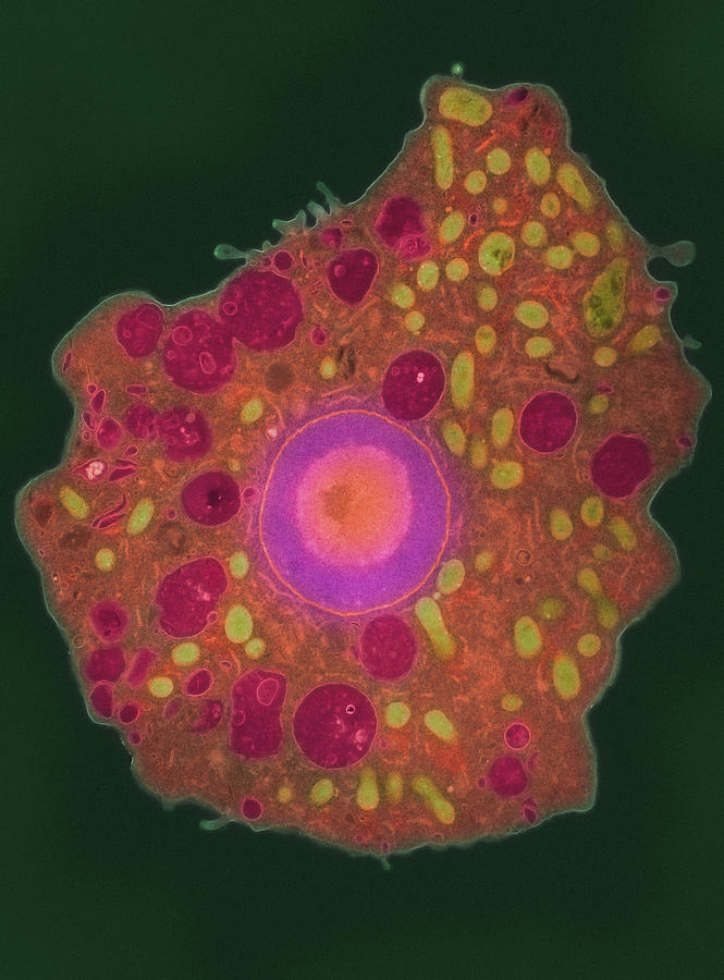 Naegleria Fowleri Protozoa, Tem Photograph by London School Of Hygiene