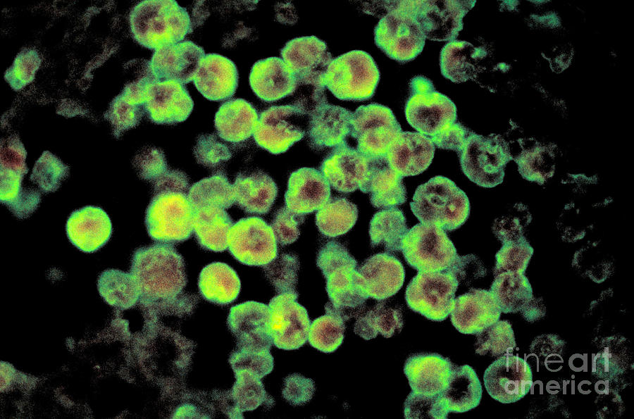 Naegleria Fowleri Photograph by Science Source