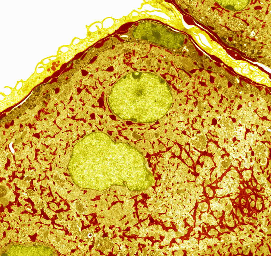 Nasal Epithelial Cells, Tem Photograph by Steve Gschmeissner | Pixels