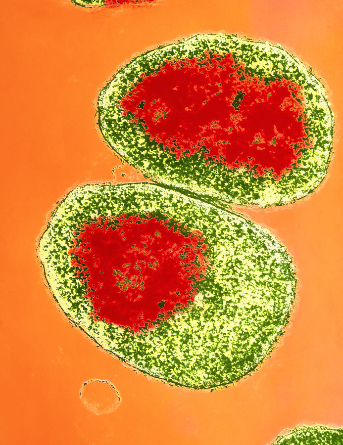 Neisseria Meningitidis Bacteria Photograph By A.b. Dowsett - Fine Art ...