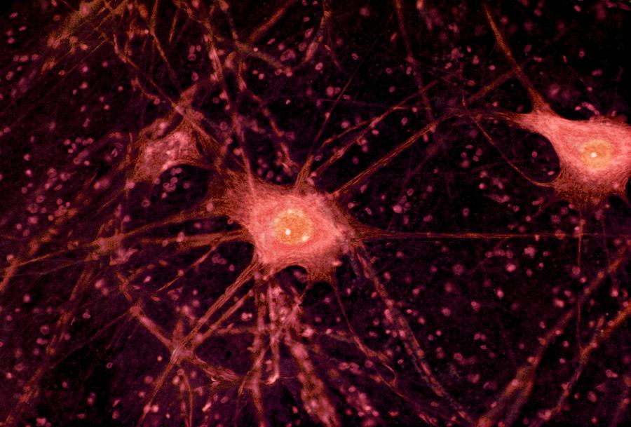Nerve Cells, Light Micrograph Photograph by Steve Gschmeissner