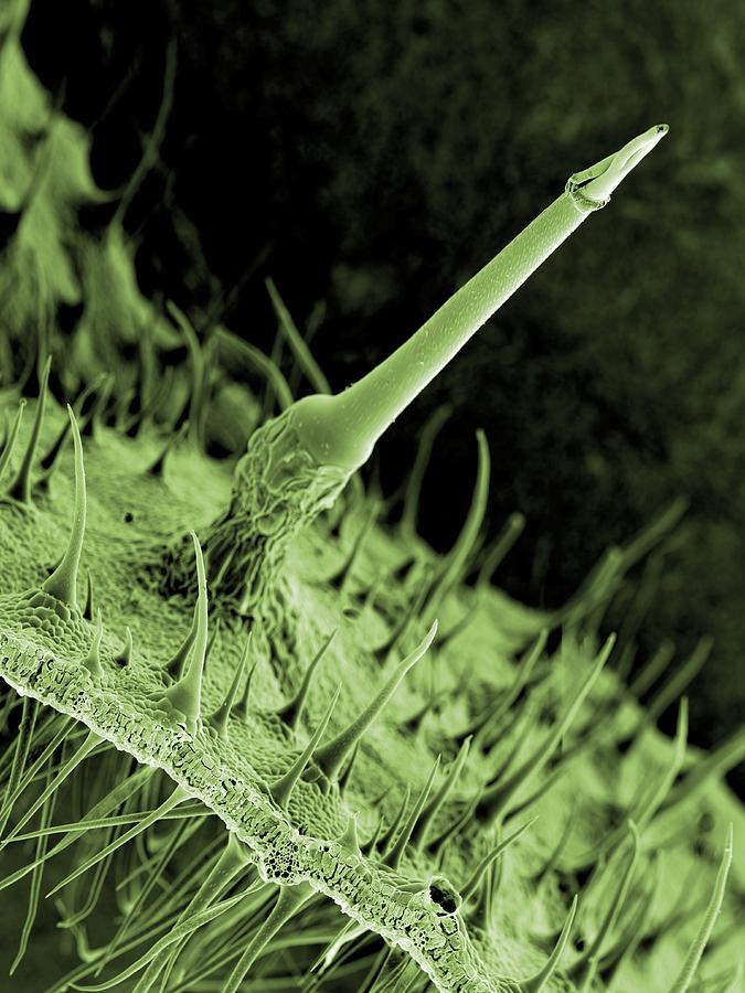 Строение волоска крапивы. Трихомы крапивы. Трихомы крапивы под микроскопом. Жгучий волосок листа крапивы. Лист крапивы под микроскопом.