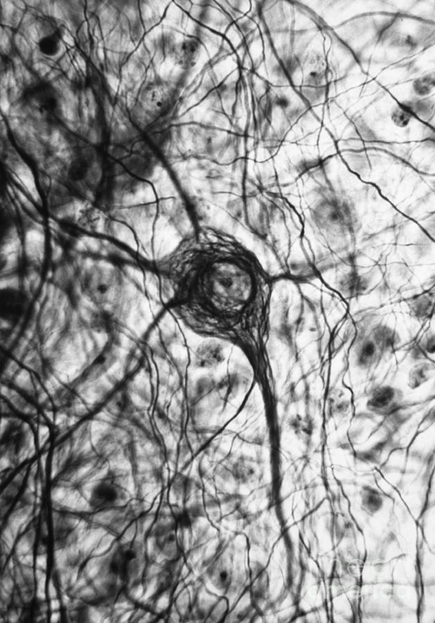 Neuron, Tem Photograph by Omikron