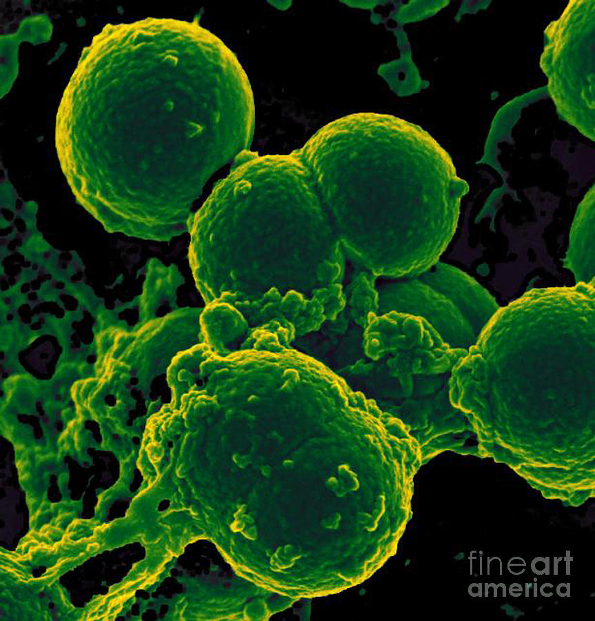 Neutrophil Ingesting Mrsa Bacteria, Sem Photograph by Science Source