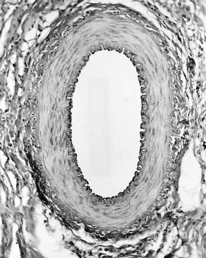Normal Artery, Tem Photograph by Omikron