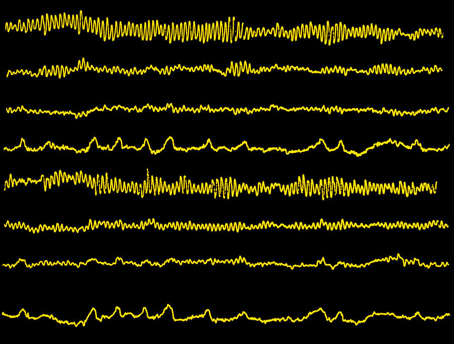 Eeg Photograph - Normal Eeg Read Out Of The Brains Alpha Waves by 