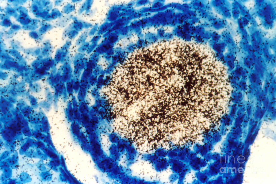 Oncogene Photograph by Science Source